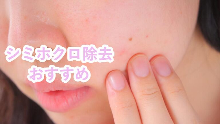 シミホクロ除去