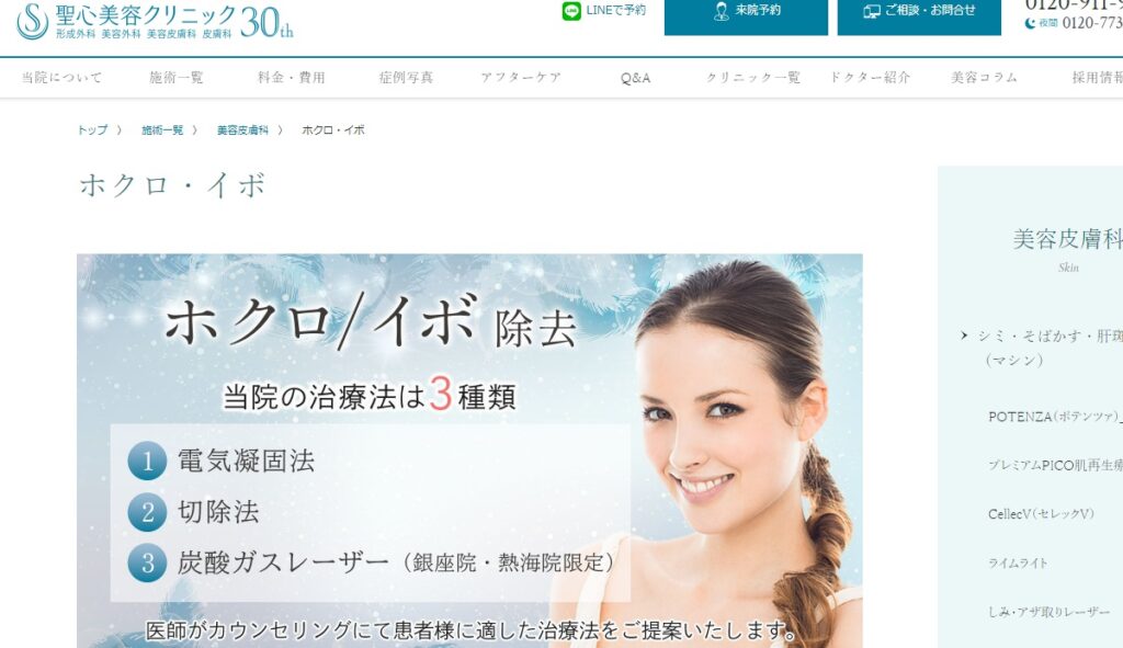 聖心美容クリニックのホクロ除去